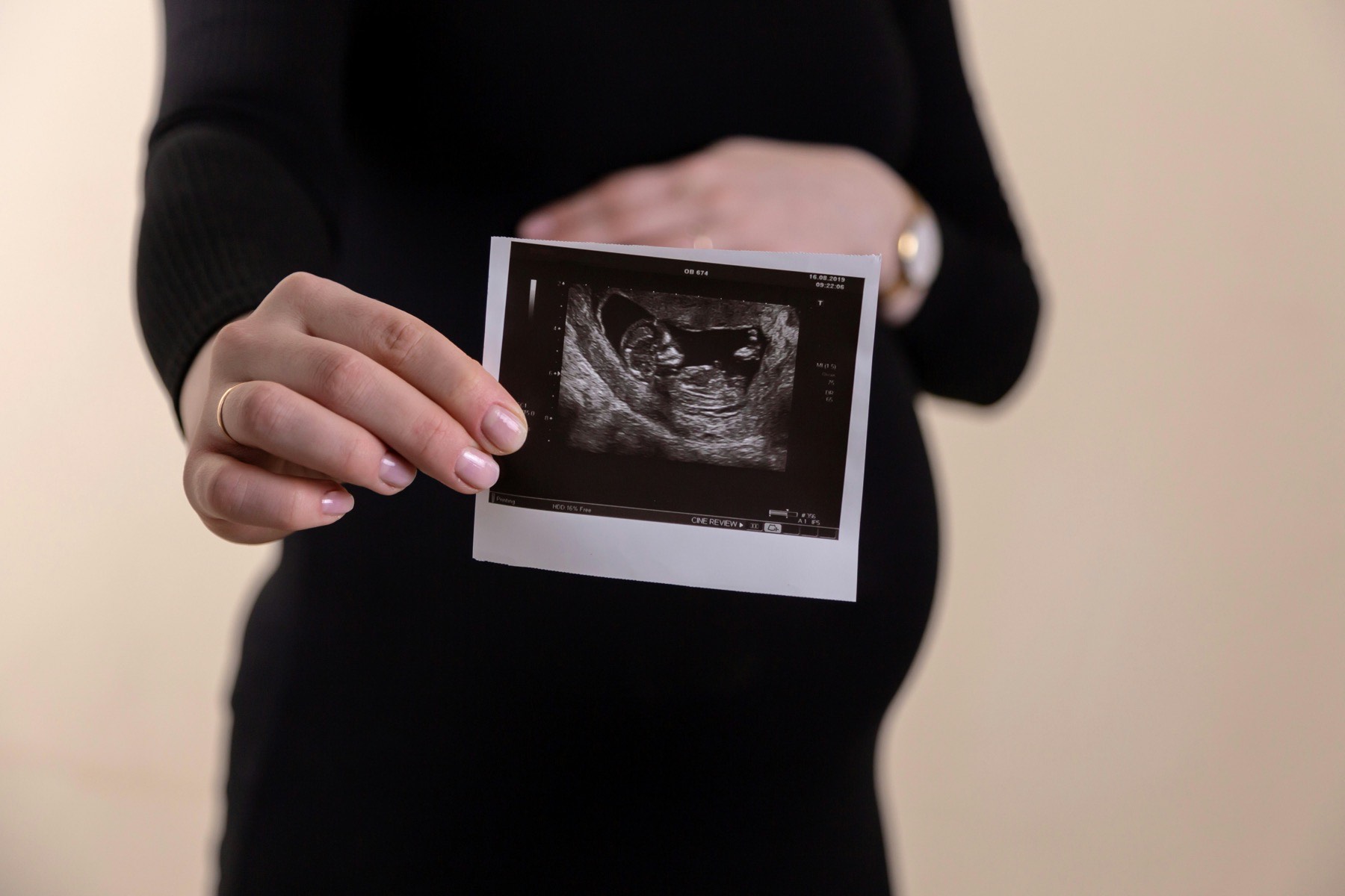 femme enceinte tenant un cliché d'échographie devant son ventre